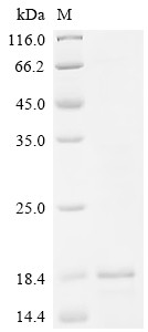 Apoptosis-associated speck-like protein containing a CARD (PYCARD), Partial, human, recombinant