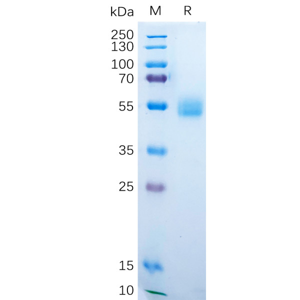 Human AMHR2 Protein, hFc Tag