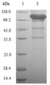 Lymphocyte activation gene 3 protein (LAG3), partial, human, recombinant