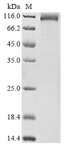 DNA polymerase theta (POLQ), partial, human, recombinant