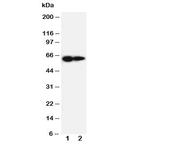 Anti-IL-2 Receptor (beta subunit)