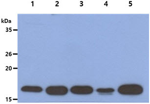 Anti-Acid Phosphatase, clone 5C11