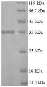 Interferon alpha-1/13 (IFNA1), human, recombinant