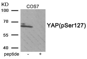 Anti-Phospho-YAP1 (Ser127)