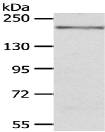 Anti-KDM6B