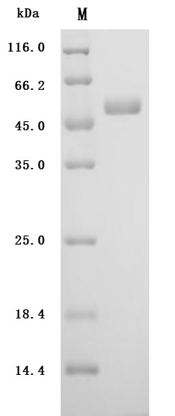 Urokinase-type plasminogen activator(PLAU) (Active), human, recombinant