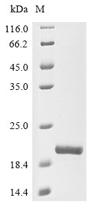 Tumor susceptibility gene 101 protein (TSG101), partial, human, recombinant