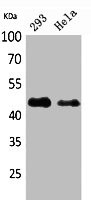 Anti-IDH1