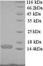 Pterin-4-alpha-carbinolamine dehydratase (PCBD1), human, recombinant