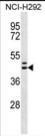 Anti-MLNR, CT (MLNR, GPR38, MTLR, MTLR1, Motilin receptor, G-protein coupled receptor 38)