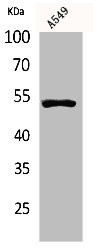 Anti-TP53