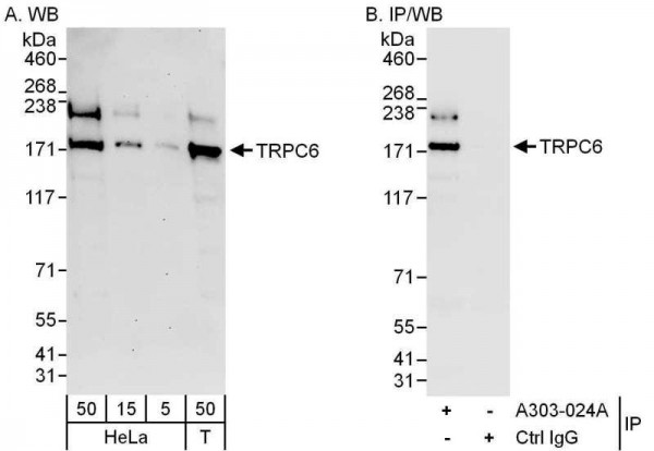 Anti-TRPC6