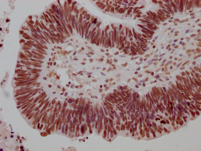 Anti-HSF1 Recombinant Monoclonal, clone 5C7