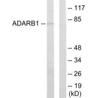 Anti-ADARB1