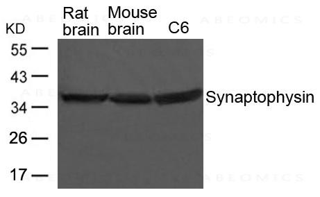 Anti-Synaptophysin