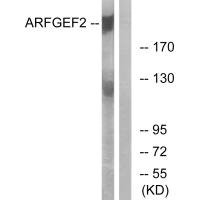 Anti-ARFGEF2