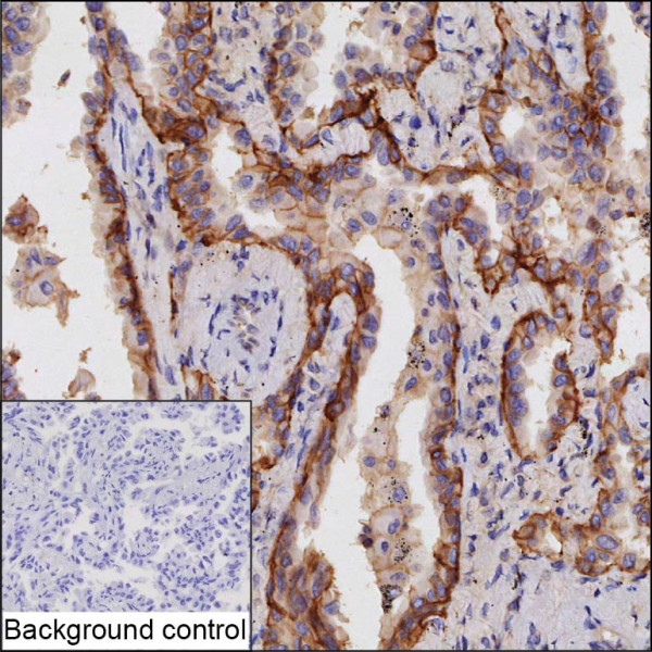 Anti-ATP1A1