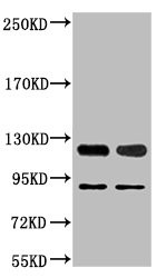 Anti-PARP1 Monoclonal