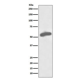 Anti-G6PD / Glucose-6-phosphate dehydrogenase, clone ABBI-7