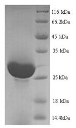 Serine protease 1 (Prss1), rat, recombinant