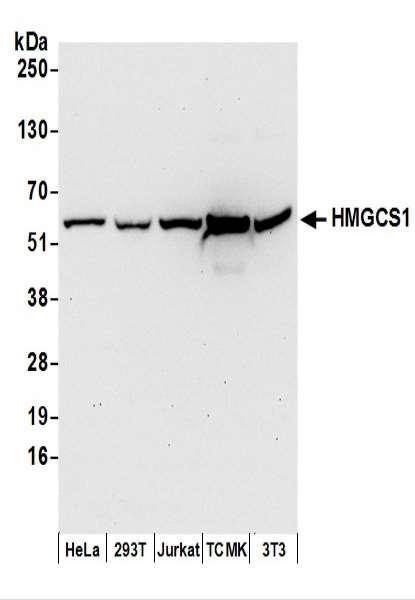 Anti-HMGCS1