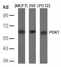 Anti-PDK1