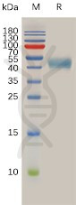 Human SSTR2 Protein, hFc Tag