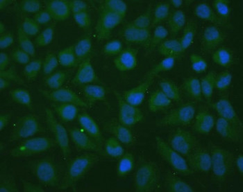 Anti-Thioredoxin 2 / TXN2, clone 7B5