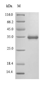 Spike glycoprotein (S), partial (Active), Severe acute respiratory syndrome coronavirus 2, recombina