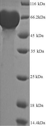 Matrix metalloproteinase-9 (MMP9), partial, human, recombinant