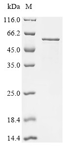 Z-DNA-binding protein 1 (ZBP1), human, recombinant