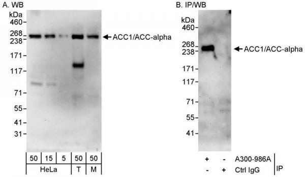 Anti-ACC1/ACC-alpha