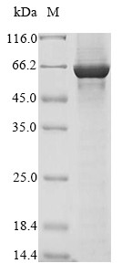 Glutamate receptor ionotropic, NMDA 1 (GRIN1),partial, human, recombinant