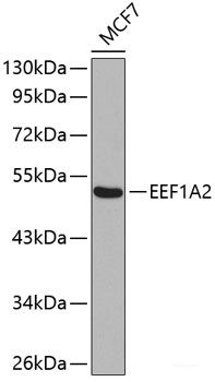 Anti-EEF1A2