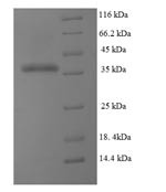 Dihydrofolate reductase (DHFR), partial, human, recombinant