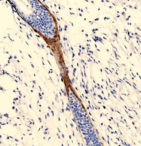Anti-Placental Lactogen, clone SQab19161