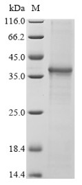 NACHT, LRR and PYD domains-containing protein 3 (NLRP3),partial, human, recombinant