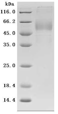 Killer cell immunoglobulin-like receptor 3DL2 (KIR3DL2), partial (Active), human, recombinant