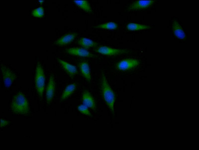 Anti-ADAM17 Recombinant Monoclonal, clone 5A1