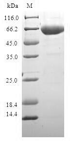 Alcohol dehydrogenase 1C (ADH1C), human, recombinant