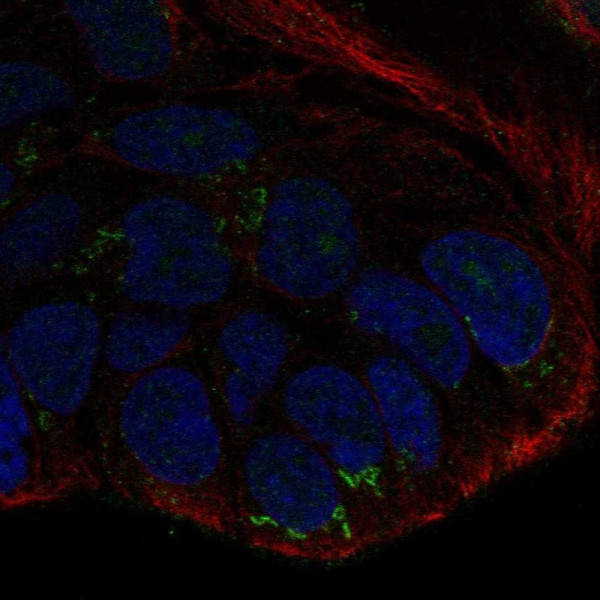 Anti-WNT10B