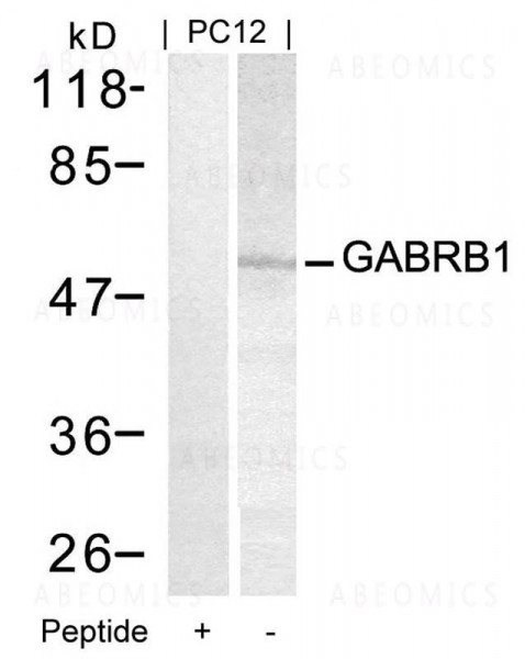 Anti-GABRB1 (Ab-434)