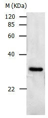 Anti-PCNA