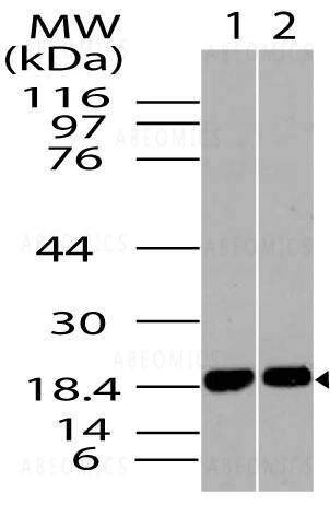 Anti-ACP1 isoform B