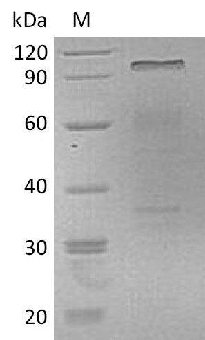 Hepatocyte growth factor (HGF) (Active), human, recombinant