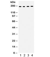 Anti-Thrombospondin / THBS1