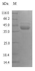 Plasma kallikrein (KLKB1), partial, human, recombinant