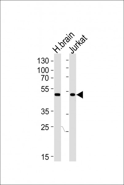 Anti-CHN1