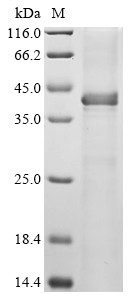 Cystathionine beta-synthase (CYS4), partial, Saccharomyces cerevisiae, recombinant