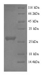 Interleukin-6 (IL6), rabbit, recombinant